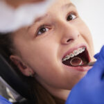 Ortodonzia Tradizionale per Bambini